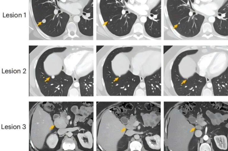 Experimental Liver Cancer Vaccine Shows Strong Early Results for Young Patients