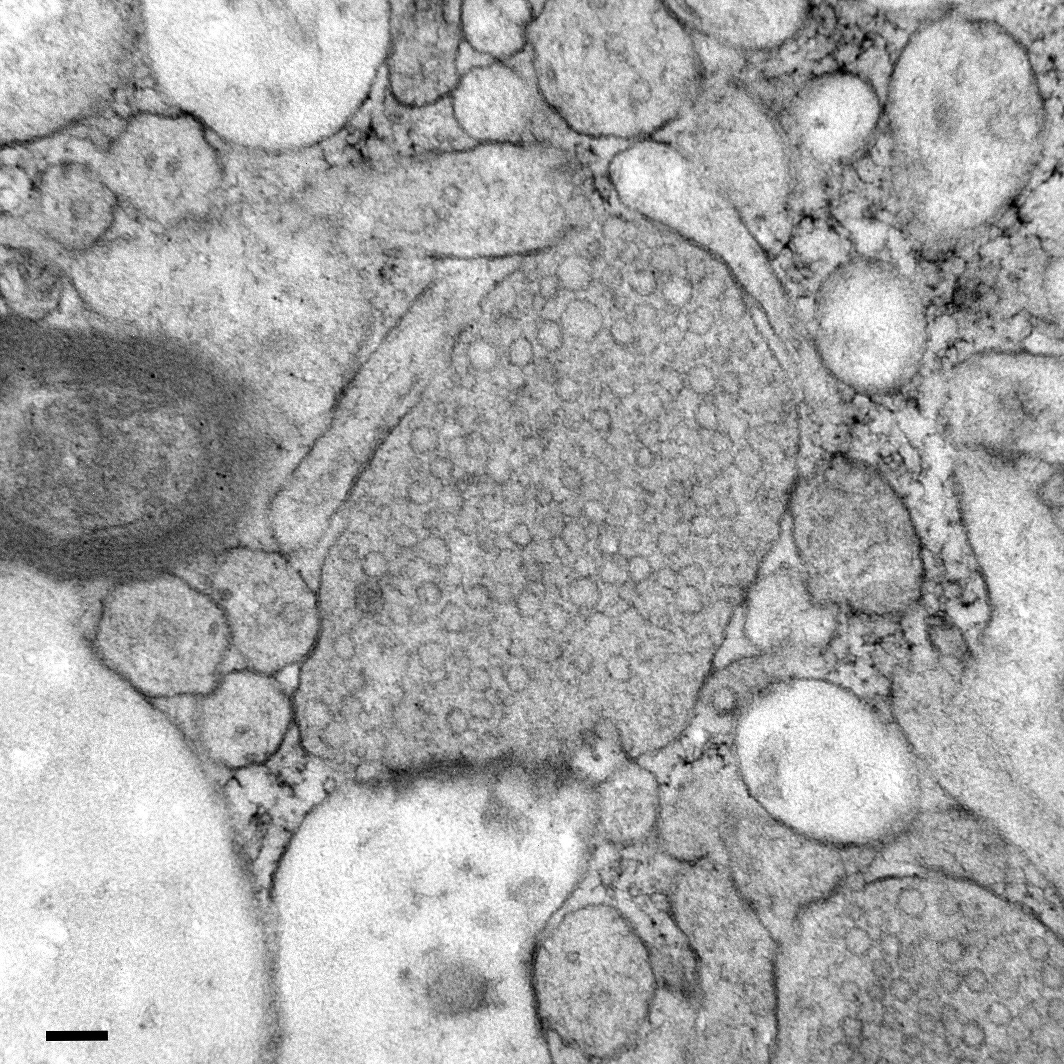 Zap-and-Freeze Technique Lets Scientists Watch Human Brain Cells Communicate in Real Time