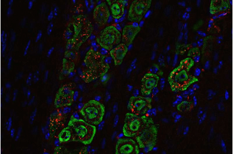 Nasal Nanomedicine Shows Powerful Potential for Treating Deadly Brain Tumors