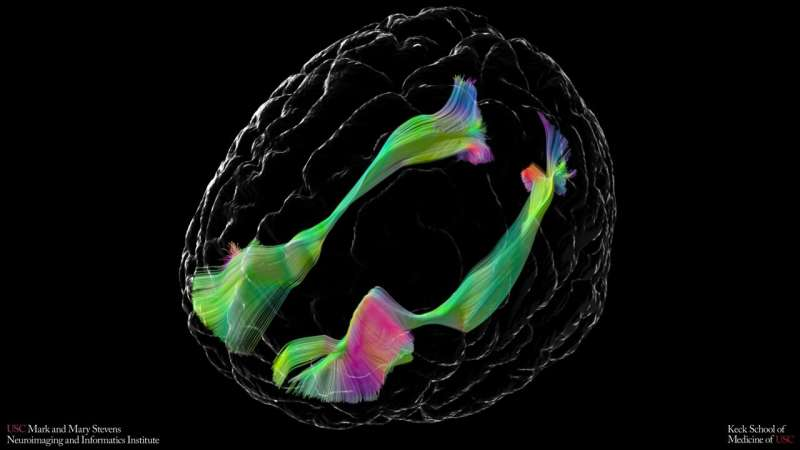 USC Researchers Map Subtle Brain Wiring Differences in Children and Young Adults With Autism