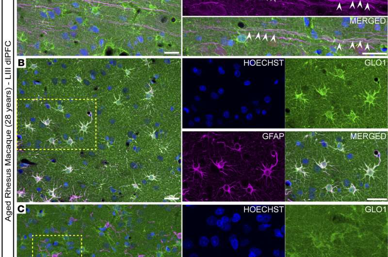 How the Brain Naturally Protects Itself From Alzheimer’s Disease and Why This Defense Weakens With Age