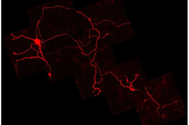 Aging Midbrain Dopamine Neurons Face an Energy Crisis That May Explain Parkinson’s Disease Progression