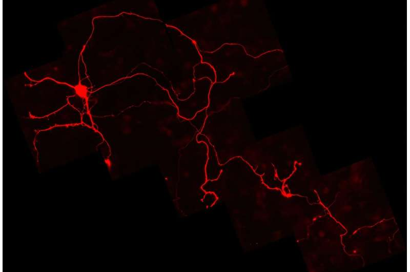 Aging Midbrain Dopamine Neurons Face an Energy Crisis That May Explain Parkinson’s Disease Progression