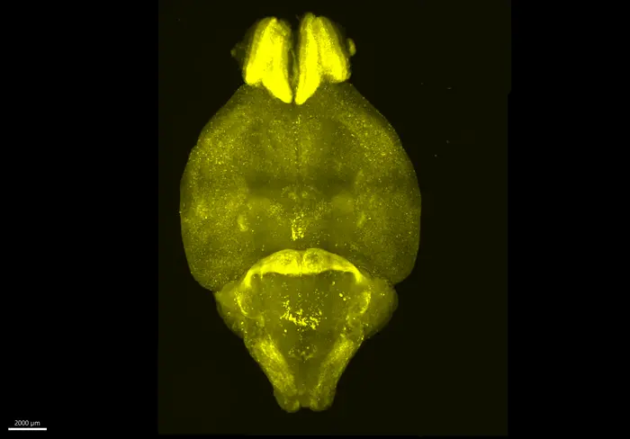 How Brain Activity Changes Throughout the Day and What It Reveals About Fatigue and Mental Health