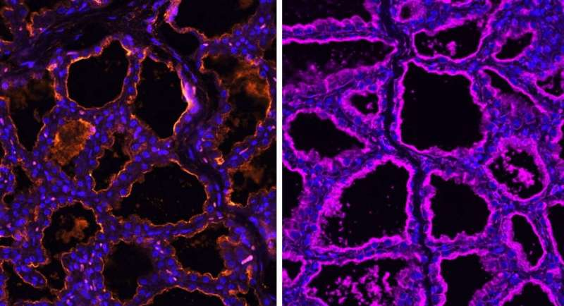 Mammary Glands in Humans and Livestock May Be Unexpected Gateways for Avian Flu