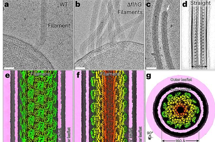 Scientists Reveal the Near-Atomic Structure of Cholera’s Flagellar Tail and Why It Matters for Treatment