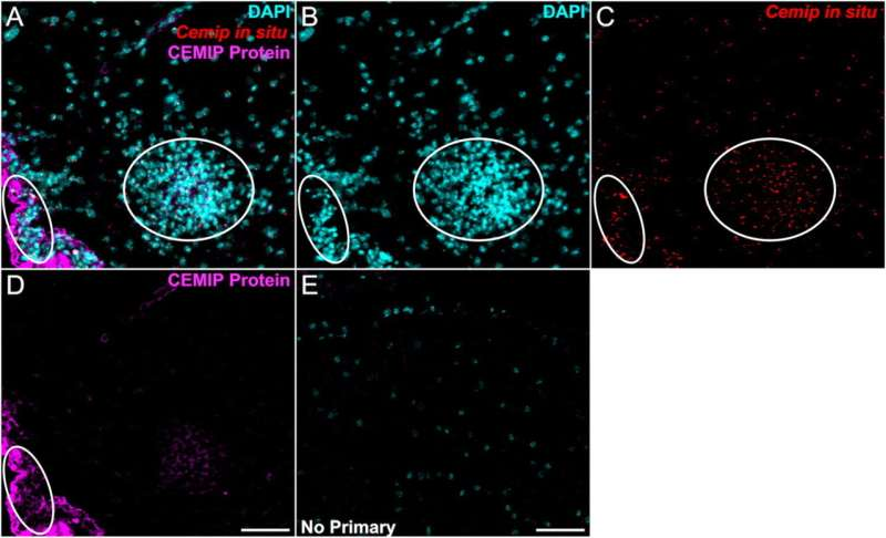 Scientists Identify a Little-Known Enzyme That Could Unlock New Treatments for Neurodegenerative Diseases