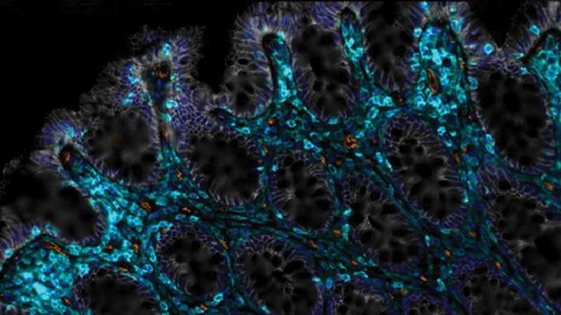 CAR T-Cell Therapy Helps Aging Intestines Heal Faster and Restore Gut Health in Mice