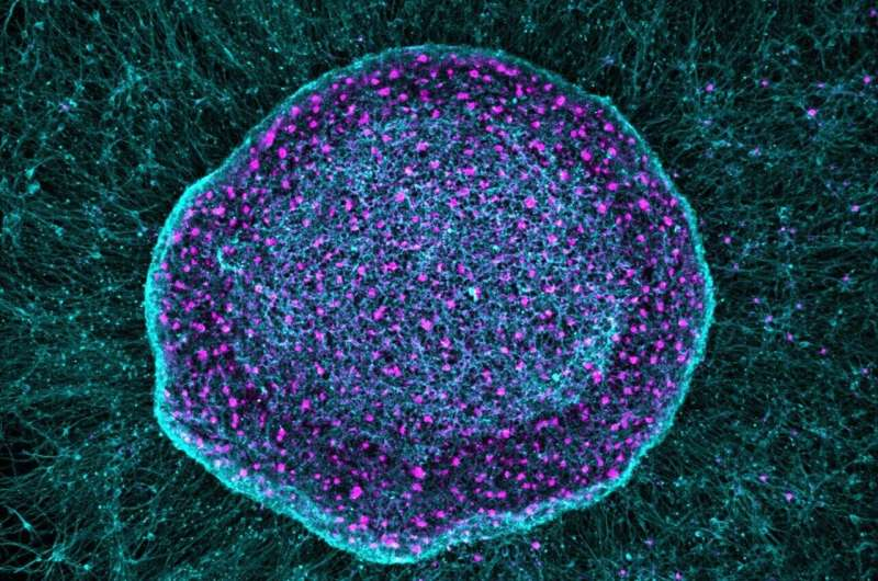 Non-Opioid Pain Sponge Therapy Using Stem Cell-Derived Neurons Shows Promise for Chronic Pain Relief and Cartilage Protection