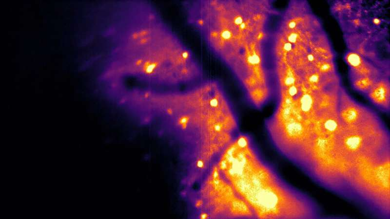 Bioluminescent Brain Imaging Tool CaBLAM Lets Scientists Watch Neural Activity Without External Lasers