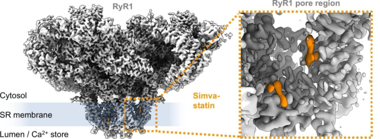Scientists Discover How Statins Can Trigger Muscle Aches and What That Means for Millions of Patients