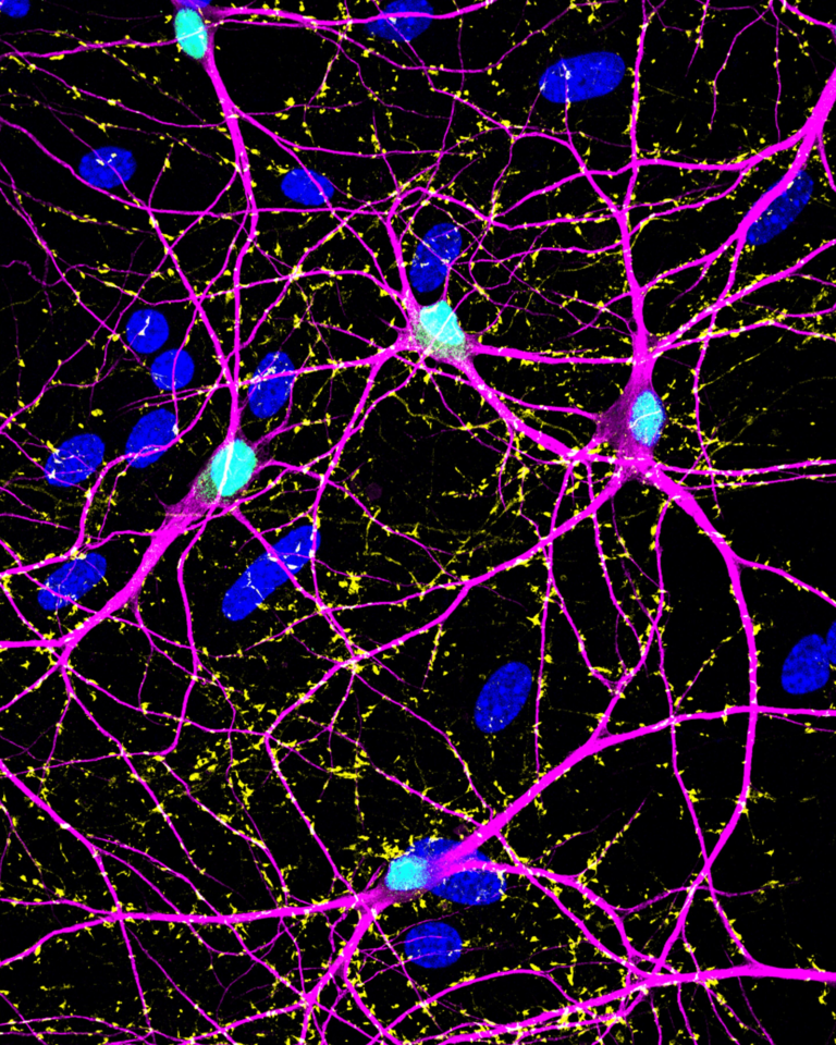 New Neuroscience Research Shows How Neurons Produce GABA Far From Synapses Without Disrupting Brain Communication