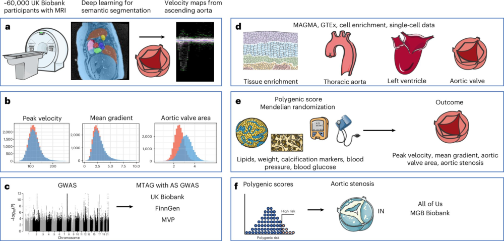 How Genetics and AI Are Transforming the Diagnosis of Aortic Stenosis