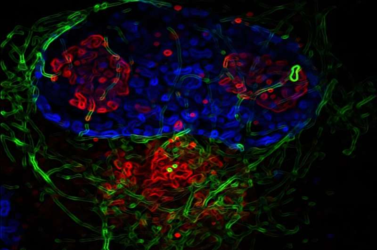 Human Cytomegalovirus Can Rewire the Cell’s Internal Structure to Promote Infection