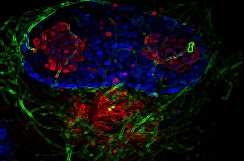 Human Cytomegalovirus Can Rewire the Cell’s Internal Structure to Promote Infection
