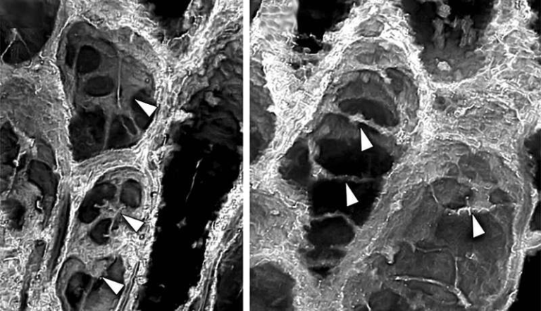 A 400-Million-Year-Old Fossil Is Revealing How Plants Evolved the Ability to Grow Into Giants