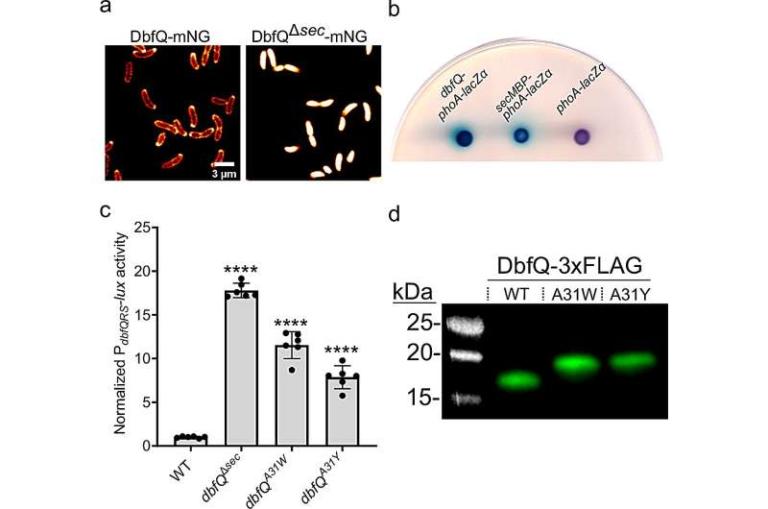 Targeting Bacterial Decision-Making Could Open a New Path to Outsmart Antibiotic Resistance