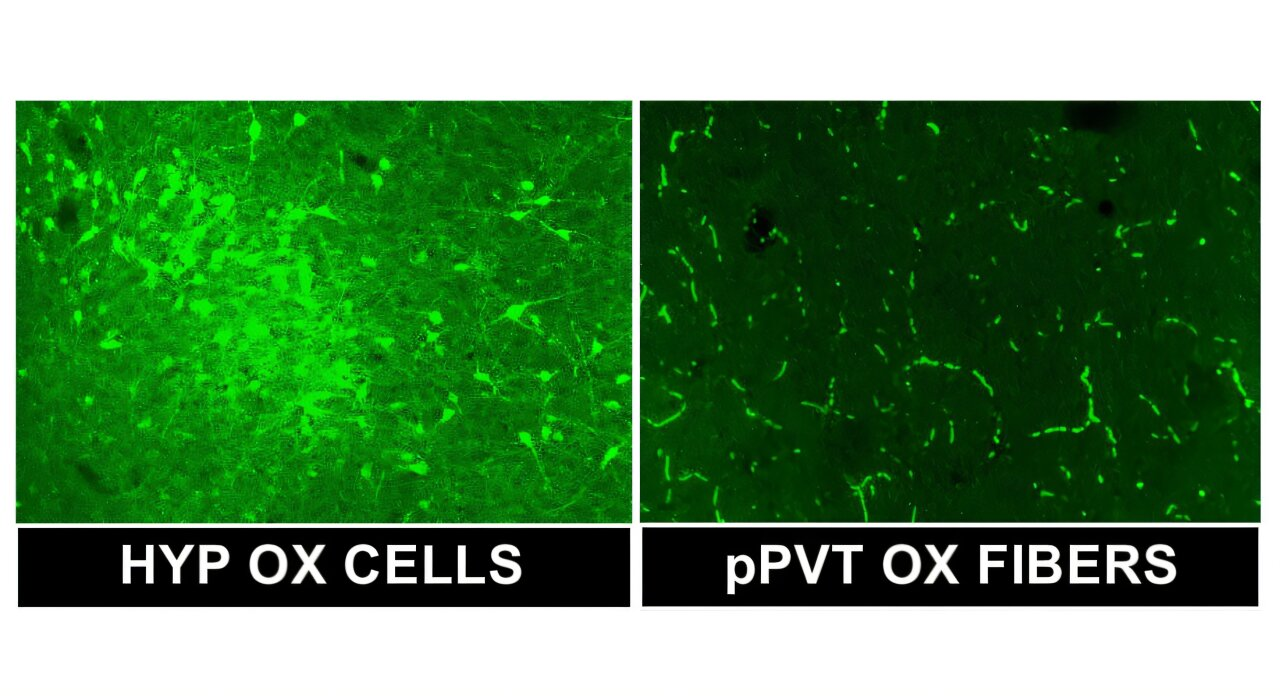 How Alcohol Dependence Disrupts Brain Balance by Altering Orexin and Dynorphin Signaling