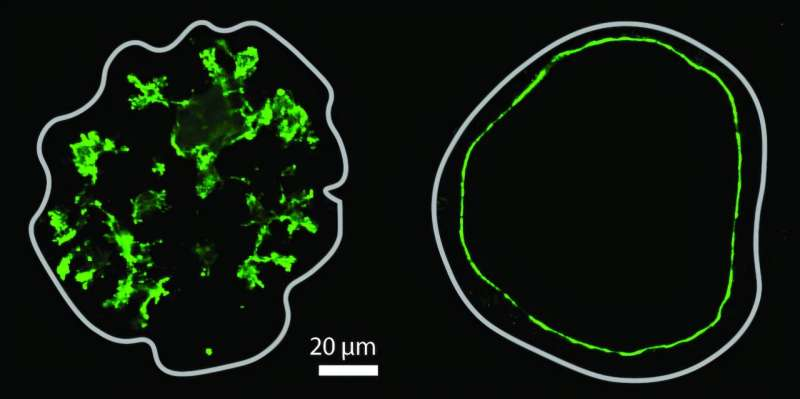 Scientists Map the Development of Pancreatic Transport Channels That Deliver Digestive Enzymes