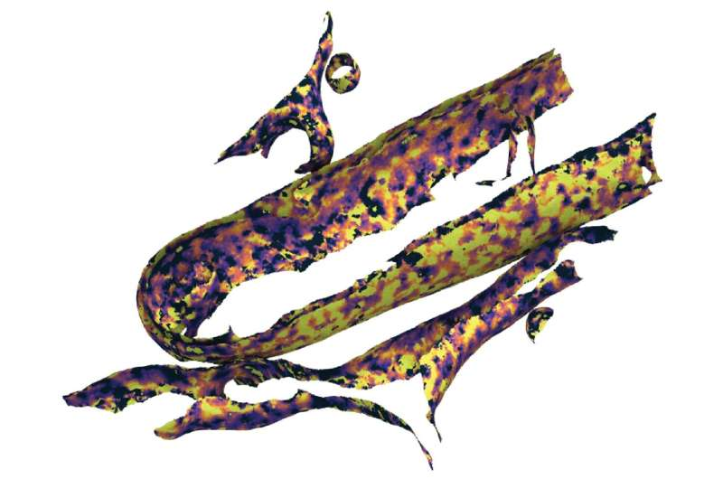 Scientists Measure Cellular Membrane Thickness Inside Cells for the First Time