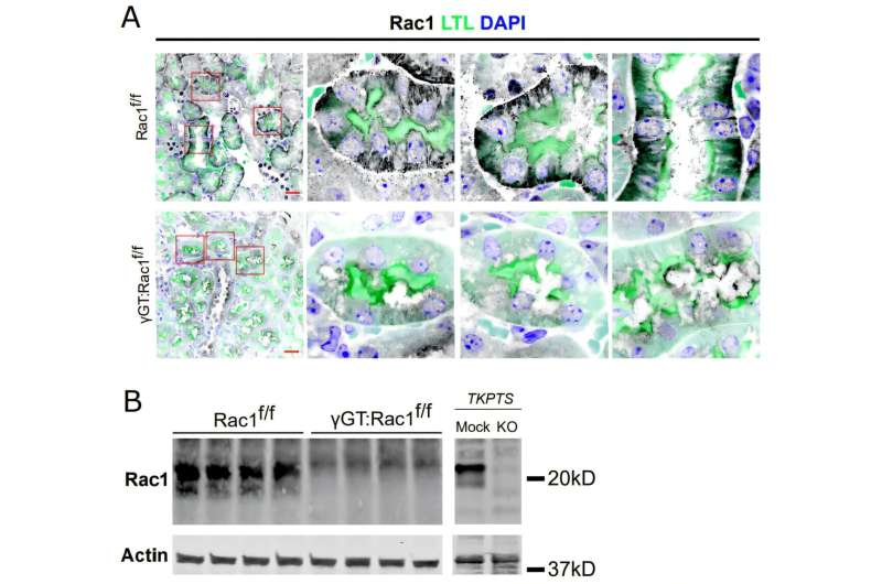 Protein Rac1 Plays Dual Roles in Repairing Damaged Kidneys, New Study Reveals