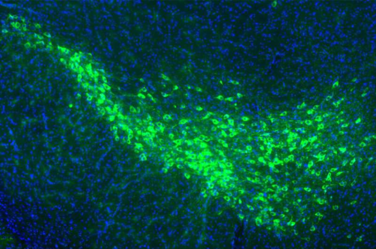 Proteins That Help Parkinson’s Disease Spread Through the Brain Have Been Identified by Researchers