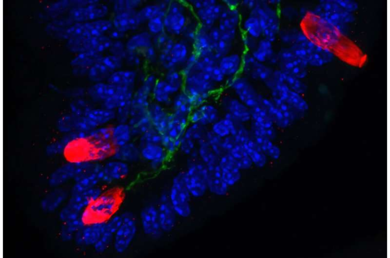 Pain-Sensing Neurons Kick-Start Immune Responses That Drive Allergies and Asthma