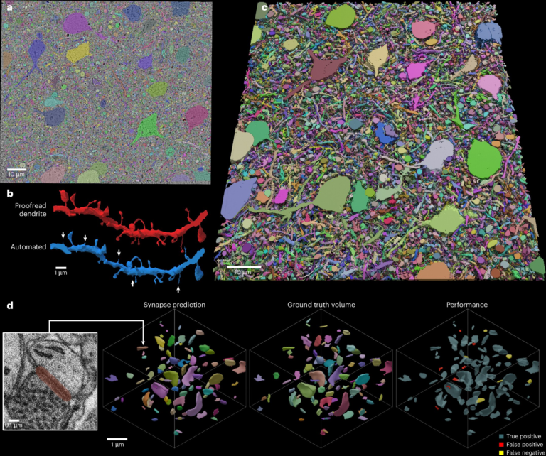 Want to Speed Brain Research It All Depends on How Smart Microscopes Look at the Brain