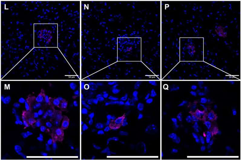 Common Brain Parasite Can Infect Your Immune Cells and Why Scientists Say That’s Probably Not a Problem