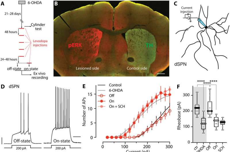 Targeting Aberrant Learning Could Improve Parkinson’s Treatment and Reduce Levodopa Side Effects