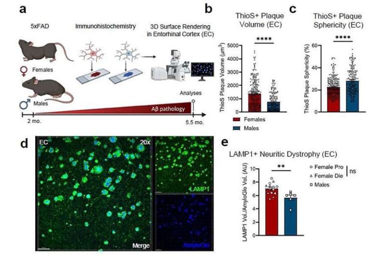 Brain Immune Cells May Be Causing More Alzheimer’s Damage in Women Than Men