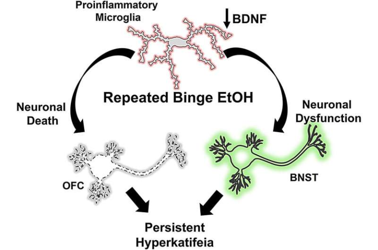 New Brain Study Explains How Binge Drinking Leads to Long-Lasting Negative Feelings