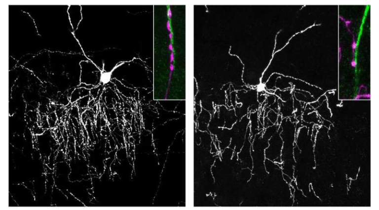 One Way Brain “Conductors” Find Their Precise Connection to Target Cells