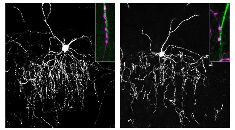 One Way Brain “Conductors” Find Their Precise Connection to Target Cells