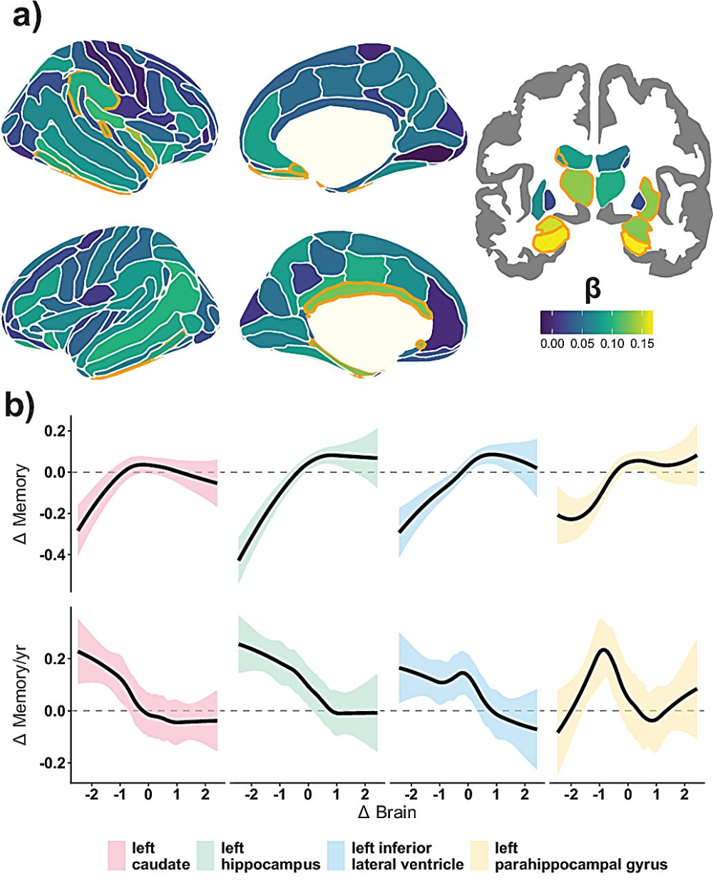 Mega-Analysis Links Widespread Brain Shrinkage to Memory Decline in Aging Mega-Analysis Links Widespread Brain Shrinkage to Memory Decline in Aging