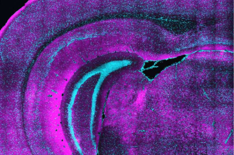 How a Unique Class of Neurons May Set the Table for Brain Development