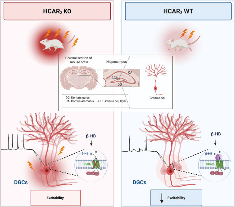 Discovery Reveals How the Keto Diet Can Prevent Seizures When Drugs Fail