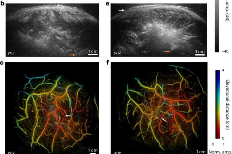 3D Hybrid Imaging System Could Address Limitations of MRI, CT and Ultrasound