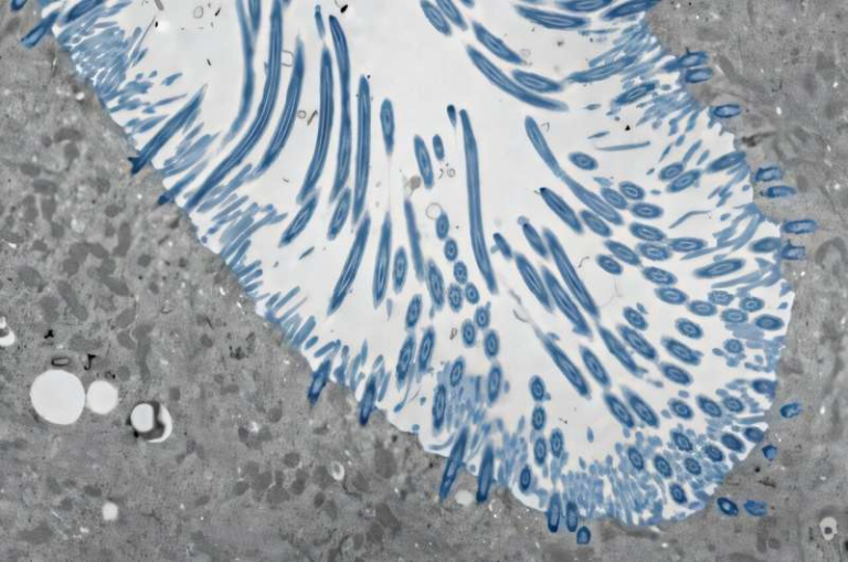 How Our Nasal Passages Defend Against the Common Cold and Influence How Sick We Get