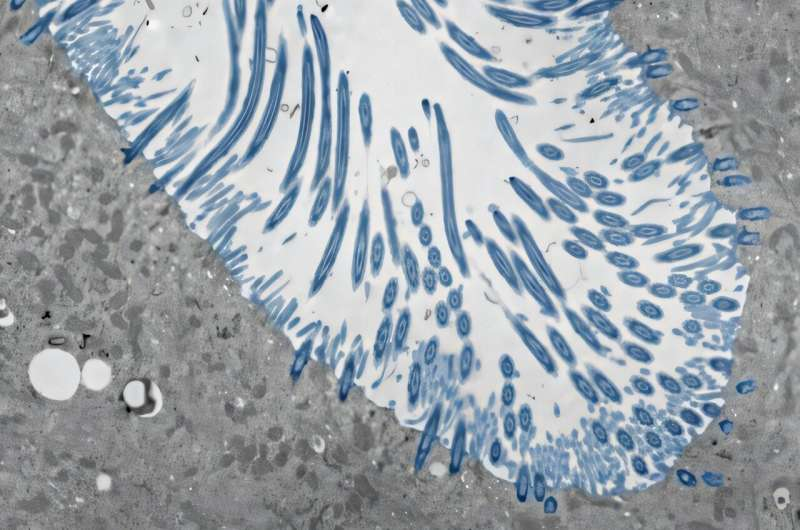 How Our Nasal Passages Defend Against the Common Cold and Influence How Sick We Get