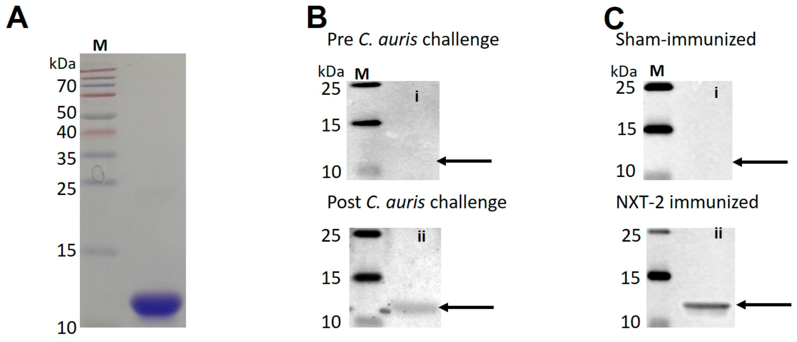 Pan-Fungal Vaccine Shows Strong Protection Against Candida auris in Mice
