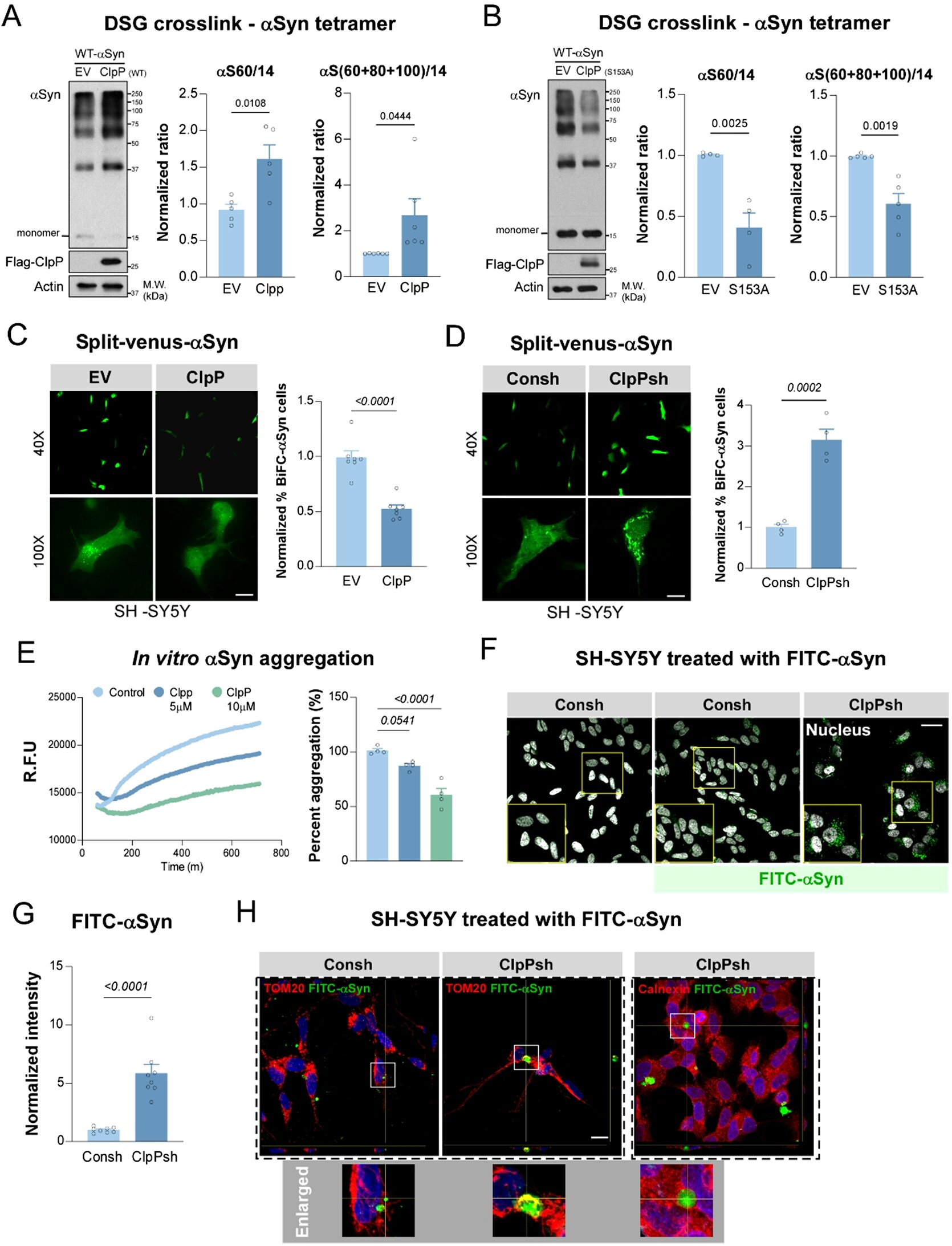 Potential New Target to Treat Parkinson’s Disease Discovered by Case Western Reserve University Researchers