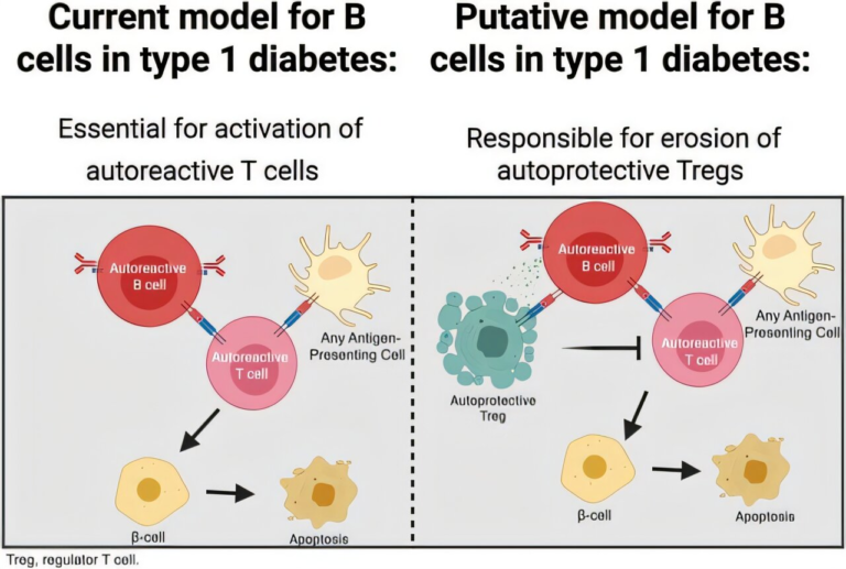 B Cells Play a More Sinister Role Than Believed in the Progression of Type 1 Diabetes
