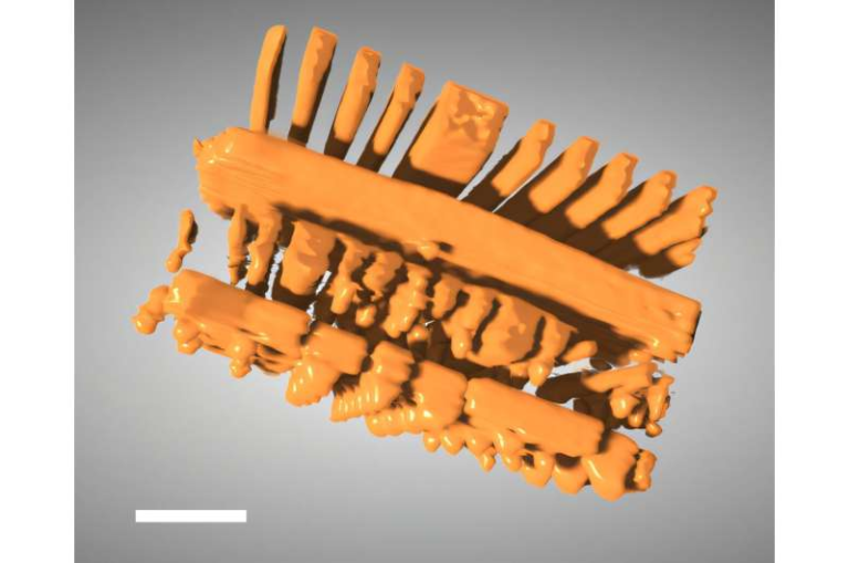Novel AI Method Sharply Improves 3D X-Ray Vision for Nanoscale Imaging