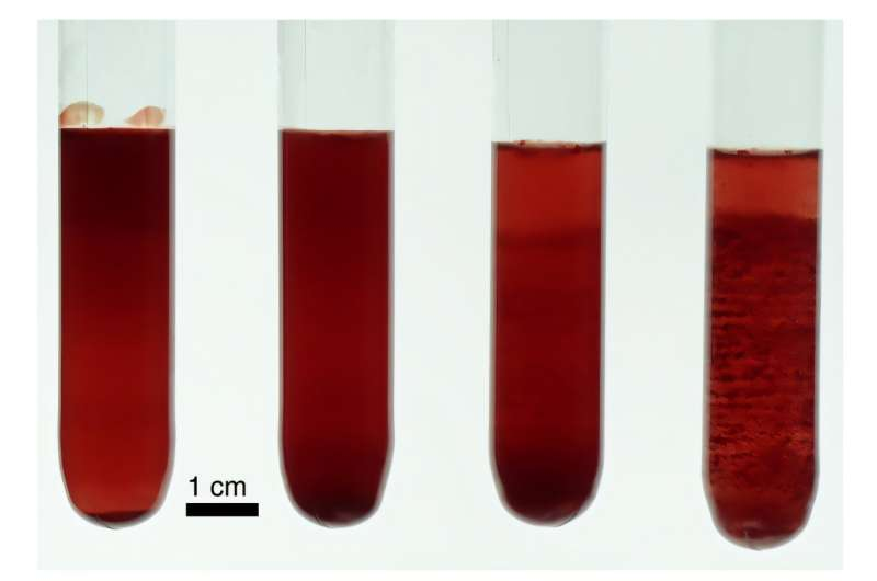 Scientists Discover Why Red Blood Cells Form Stripe Patterns and How This Could Improve Blood Disorder Diagnosis
